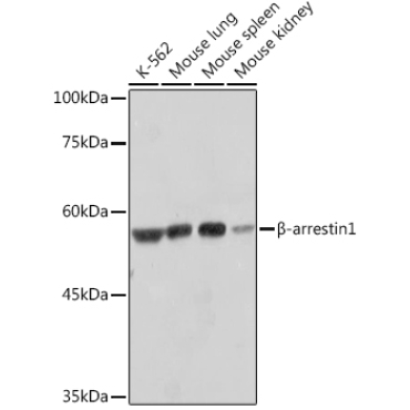 Beta-arrestin1 Rabbit Monoclonal Antibody