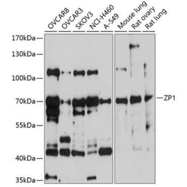 ZP1 Rabbit Polyclonal Antibody