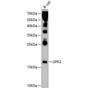 UPK2 Rabbit Polyclonal Antibody