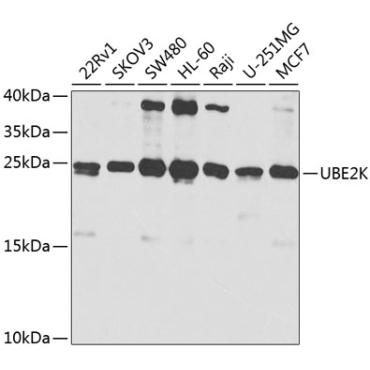 UBE2K Rabbit Polyclonal Antibody