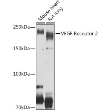 VEGF Receptor 2 Rabbit Polyclonal Antibody