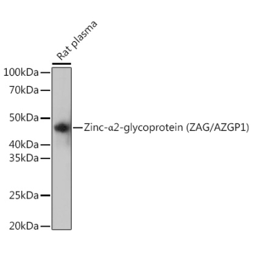 Zinc-Alpha2-glycoprotein (ZAG/AZGP1) Rabbit Monoclonal Antibody