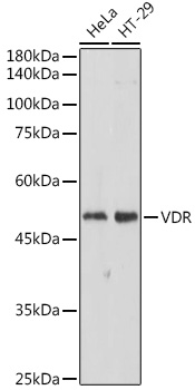 VDR Rabbit Polyclonal Antibody