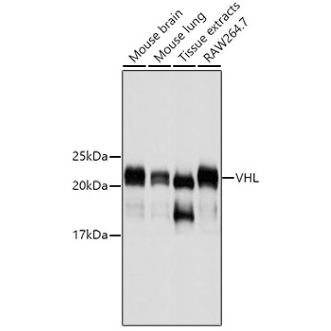 VHL Mouse Monoclonal Antibody