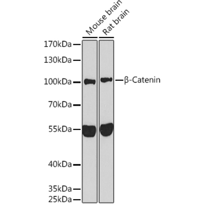 Beta-Catenin Rabbit Polyclonal Antibody