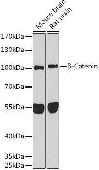 Beta-Catenin Rabbit Polyclonal Antibody
