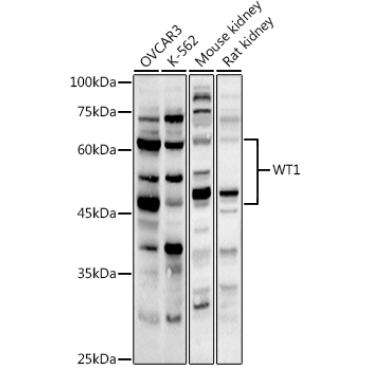 WT1 Rabbit Polyclonal Antibody