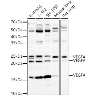 VEGFA Rabbit Polyclonal Antibody