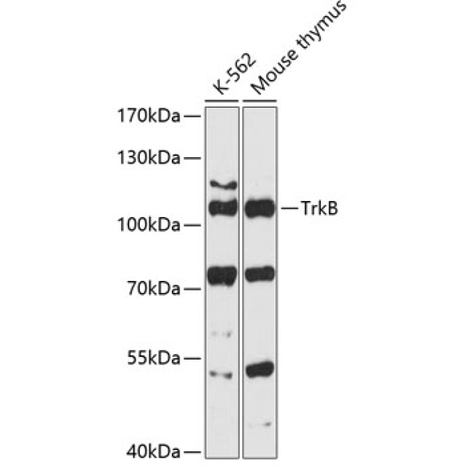 TrkB Rabbit Polyclonal Antibody