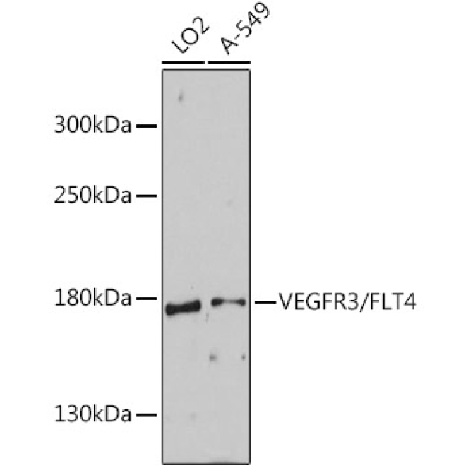 VEGFR3/FLT4 Rabbit Polyclonal Antibody