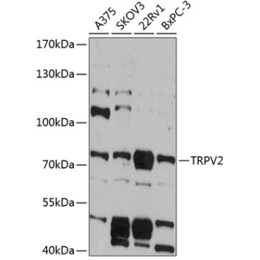 TRPV2 Rabbit Polyclonal Antibody