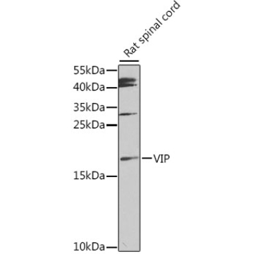 VIP Rabbit Polyclonal Antibody