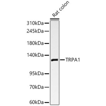 TRPA1 Rabbit Polyclonal Antibody