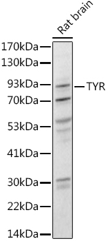 Tyrosinase Rabbit Polyclonal Antibody