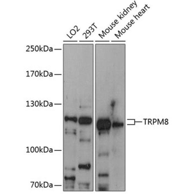 TRPM8 Rabbit Polyclonal Antibody