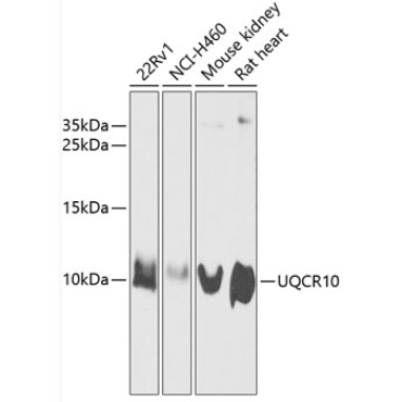 UQCR10 Rabbit Polyclonal Antibody