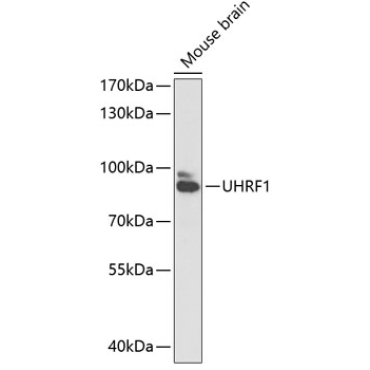 UHRF1 Rabbit Polyclonal Antibody