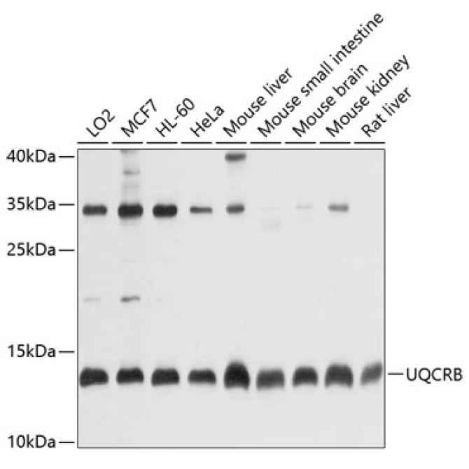 UQCRB Rabbit Polyclonal Antibody