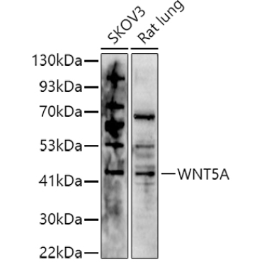 WNT5A Rabbit Polyclonal Antibody