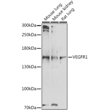 VEGFR1 Rabbit Polyclonal Antibody