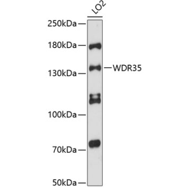 WDR35 Rabbit Polyclonal Antibody