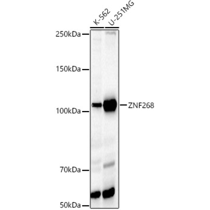 ZNF268 Rabbit Polyclonal Antibody