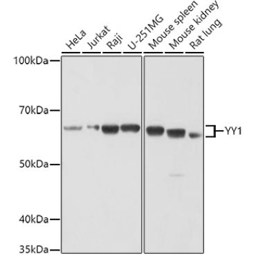 YY1 Rabbit Polyclonal Antibody