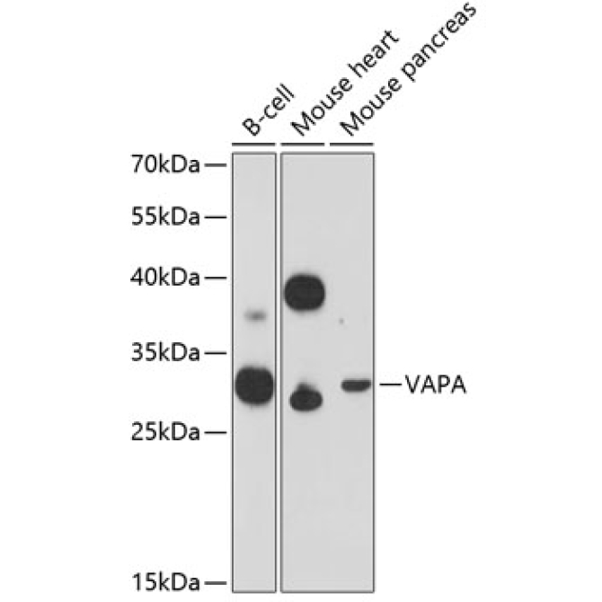 VAPA Rabbit Polyclonal Antibody