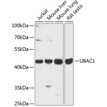 UBAC1 Rabbit Polyclonal Antibody