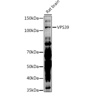 VPS39 Rabbit Polyclonal Antibody