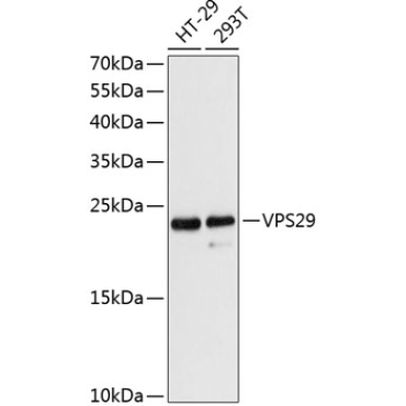 VPS29 Rabbit Polyclonal Antibody