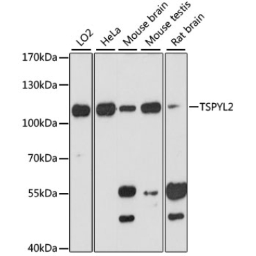 TSPYL2 Rabbit Polyclonal Antibody
