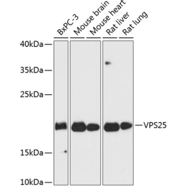 VPS25 Rabbit Polyclonal Antibody