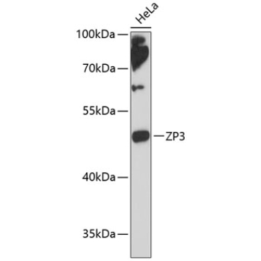 ZP3 Rabbit Polyclonal Antibody