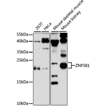 ZNF581 Rabbit Polyclonal Antibody