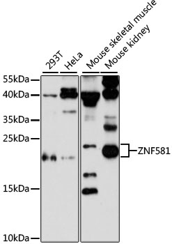 ZNF581 Rabbit Polyclonal Antibody