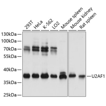 U2AF1 Rabbit Polyclonal Antibody