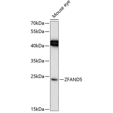 ZFAND5 Rabbit Polyclonal Antibody