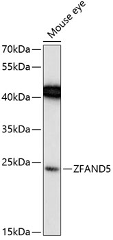 ZFAND5 Rabbit Polyclonal Antibody