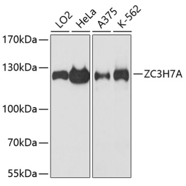 ZC3H7A Rabbit Polyclonal Antibody