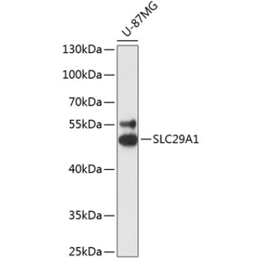 SLC29A1 Rabbit Polyclonal Antibody