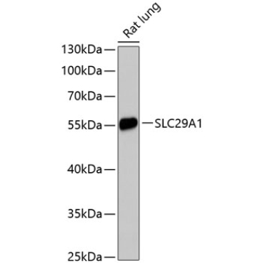 SLC29A1 Rabbit Polyclonal Antibody