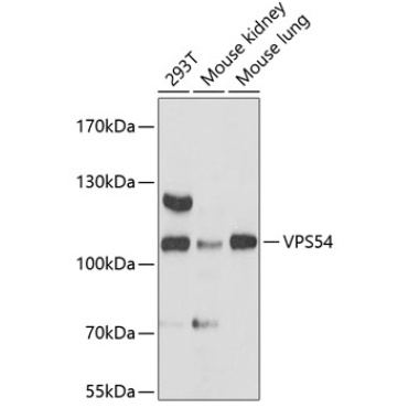 VPS54 Rabbit Polyclonal Antibody