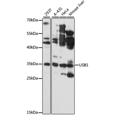 USB1 Rabbit Polyclonal Antibody
