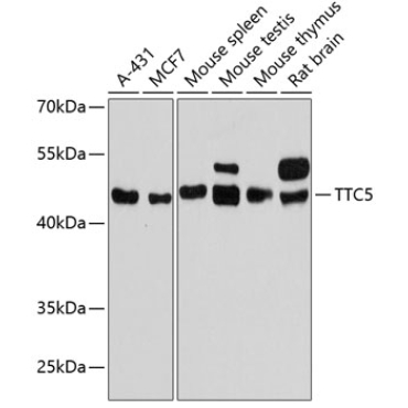 TTC5 Rabbit Polyclonal Antibody
