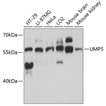 UMPS Rabbit Polyclonal Antibody