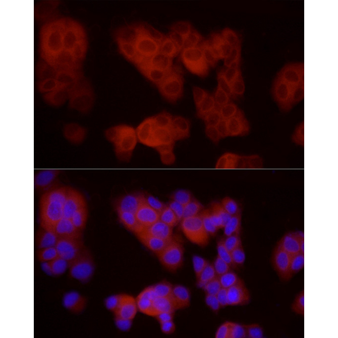 VEGFR3/FLT4 Rabbit Polyclonal Antibody