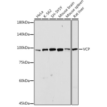 VCP Rabbit Polyclonal Antibody