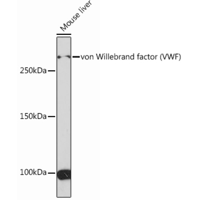 von Willebrand factor (VWF) Rabbit Monoclonal Antibody