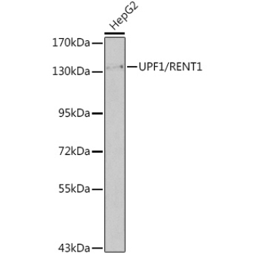 UPF1/RENT1 Rabbit Polyclonal Antibody